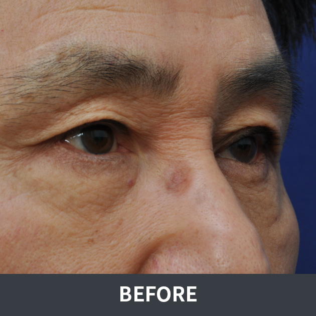 afterPhoto
